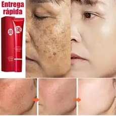 20g Creme Clareador de Manchas,Creme anti-rugas,para cuidados com a pele/iluminação da pele,Reduzir marcas de acne