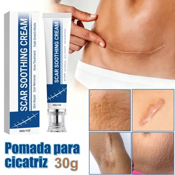 Pomada eficaz para remoção de cicatrizes pode ser usada em queimaduras,cicatrizes cirúrgicas,estrias,amolecendo as cicat