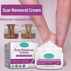 Creme Para Remoção De Cicatrizes Cravos , Feridas Antigas , Picadas De Mosquitos , Quelóides , Queimaduras , Couro Cabel