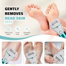 Removedor elétrico de milho para pés, esfoliante elétrico para pés, removedor profissional portátil de milho para pés