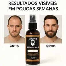 Tônico Capilar 15% Anti Queda Serum de Crescimento Poderoso Barba Cabelo Sobrancelha Bigode Kit i