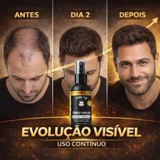 Tônico Capilar 15% Anti Queda Serum de Crescimento Poderoso Barba Cabelo Sobrancelha Bigode Kit c