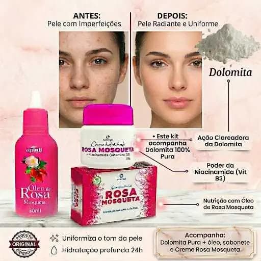 Kit Rosa Mosqueta Completo: Creme Clareador Niacinamida+ Sabonete+  Oleo Rosa Mosqueta + Dolomita Pura