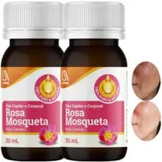 Óleo Rosa Mosqueta 30ml 100% Puro Sobral Corporal Hidrata Pele Cosmético Natural Vegetal Hidratação