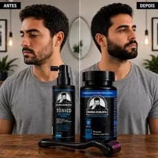 Kit Barba Crescimento completo, com Tônico de Crescimento, Multivitamínico e Derma Roller – Barba Robusta Original