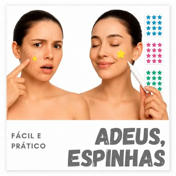 Adesivo Seca Espinha Estrela Anti‑acne, Proteção Dia/Noite Secativo