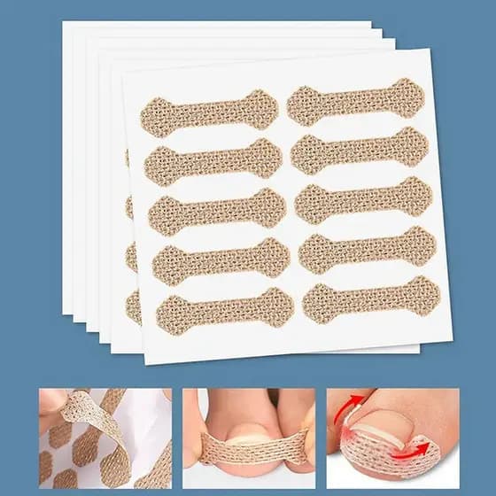100 adesivos para correção de unhas, ferramentas para cuidados com os pés, tratamento e reparação de unhas encravadas
