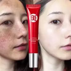 Creme Forte Original Para Remover Manchas Escuras/Clareamento Pigmentado/Cuidados Com A Pele QRJZ DV4D