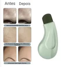 Espátula Facial Profissional para Limpeza Profunda de Cravos e Espinhas