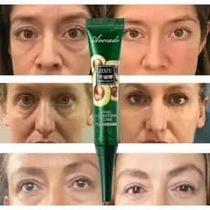 Creme De Olhos Gel Dark Circles Remoção Instantânea Antirrugas Anti-Bolsas/Anti-Puffiness Apertar Retinol 20g