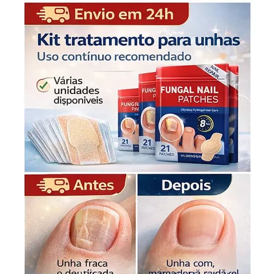 210 Pçs Adesivo Tratamento para Unhas, Reparação De Unhas Remendo Cinza Correção Fúngica Adesivo