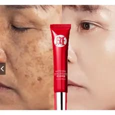 Clareamento E Remoção De Sardas Creme Hidratante Suave Reparo Desbotar A Marca Da acne Removedor