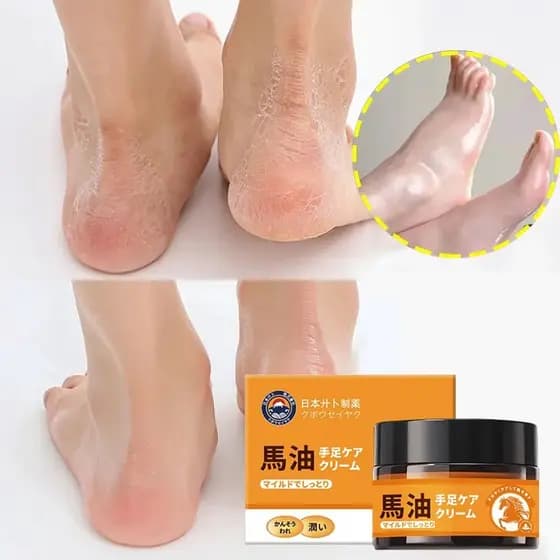 Óleos De Cavalo Creme Para Pés Anti-Rachaduras Hidratante Reparador De Pele Calcanhar
