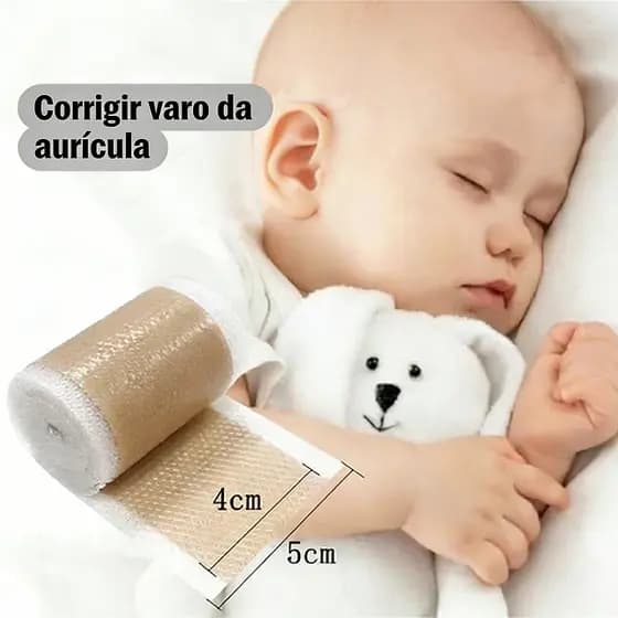 Fita Silicone Corretor Orelha Bebê Correção Infantil Aurícula Varus Seguro & Soft