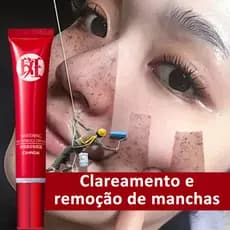 Poderoso Creme Original Para Remover Manchas Escuras/Iluminar A Pigmentação O Tom Da Pele/Melhorar Embotamento/Cuidados