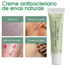 Creme Para A Pele , Antibacteriano Eczema , Pomada Dermatites E Eczematoide Cuidados Com Inibição De Aprendizagem (Volu)