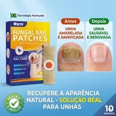 Kit 10 Adesivos Warzn para Unhas: Cuidado Intensivo Noturno e Reparação de Manchas - Fácil de Usar e Levar (7x10cm)