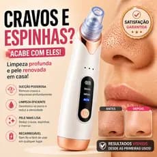 Removedor de Cravos SkinVac Ultra Sucção Profunda Sem Dor Limpeza Facial Profissional Portátil