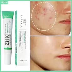 Creme para acne contendo ácido salicílico, remove oleosidade e cravos, e melhora o efeito de clareamento NJVW