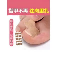 Adesivo positivo para unhas, ranhura para unhas encravadas, correção de unhas, corretor de unhas, adesivo de correção de