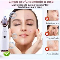 Removedor de Cravos e Espinhas Elétrico a Vácuo para Limpeza Facial/Rosto