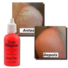 Gota Milagrosa loção 30ml Natty Vida