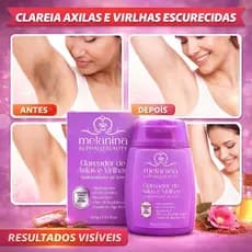 Clareador de Axilas e Virilhas Melanina Phállebeauty 100g Clareia Manchas Íntimas Niacinamida