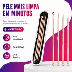Kit Removedor de Cravos e Espinhas Inox 4 Peças Com Estojo Rose Gold