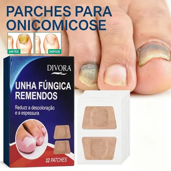 Adesivo para cuidados com as unhas alivia unhas amarelas Manicure frágil