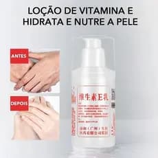 Loção Corporal Com Vitamina E – Umidade Profunda Para Pele Seca , Antienvelhecimento , Antialérgica , Segura A Família (