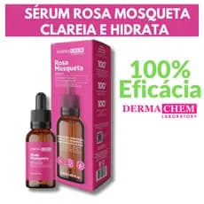 Sérum Facial Rosa Mosqueta Clareador Uniformiza Manchas e Hidratante Pele 30ML Dermachem