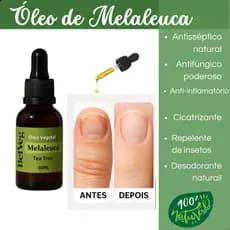 Óleo Vegetal Melaleuca Tea Tree 100% Puro 30ml  Para Unha Pele Cabelo..