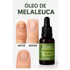 Óleo Vegetal Melaleuca Tea Tree 100% Puro 30ml Para Unha Pele Cabelo antifúngico micose