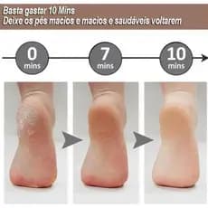 Lixa de Pé Elétrica Recarregável – Remoção Eficiente de Calos e Pele Morta, Design Ergonômico, À Prova D
