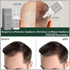 Deoxyribose Sugar Gel 60ml Espessamento Capilar Fortalecedor Suplemento Para Couro Cabeludo Crescimento pomuisbr