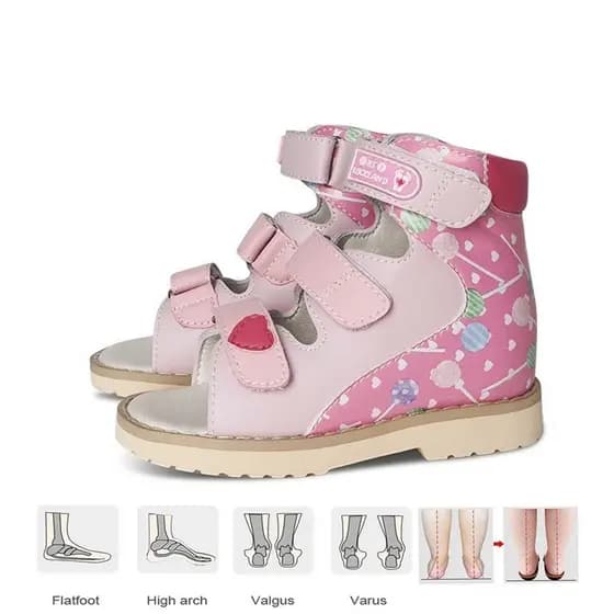 Sapatos de Verão para Meninas, Novas Sandálias Ortopédicas Rosa Flapeet Varo para Bebês FXFK