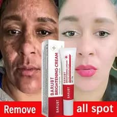 Clareamento Sardas Creme Facial Remoção Melasma Manchas Escuras Cor