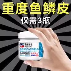 [Japão の Farmacêutico] Creme para pele de cobra com escama de peixe Loção corporal Hidratante Loção hidratante para pele