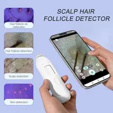 Microscópio Digital Foreverlily USB Para Couro Cabeludo-Detector Multifuncional De Folículo Capilar Com Análise Precisa