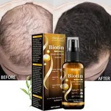 IBeaLee solução de cuidados capilares fortalecer a nutrição do cabelo evitar queda hidratante raízes densas do cabelo ma