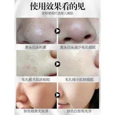 Creme de massagem Facial salão de beleza dedicado poros limpos limpeza profunda remover rosto coisas sujas poros bloquei