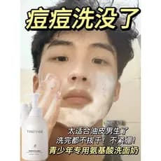 Lista de classificação de limpador Facial juvenil masculino, primeiro lugar adequado para remoção de ervilhas, meninos,