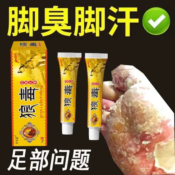 Lobo veneno pé rei pé gás medicina pé ar Anti-coceira peeling esterilização efeito especial creme mau pé medicina peelin