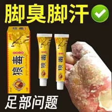 Lobo veneno pé rei pé gás medicina pé ar Anti-coceira peeling esterilização efeito especial creme mau pé medicina peelin
