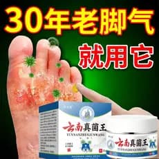 Yunnnan fungo rei pé peeling de ar coceira nos pés odor do pé coceira creme para os pés evitar imersão em água peeling p