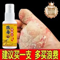 Lobo veneno spray pé rei pé ar dedicado coceira vermelha infecção fungo água Peeling pé ruim pequena bolha coceira mau m