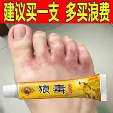 Lobo veneno pé ar rei creme para os pés vermelho coceira creme infecção fungo água Peeling pé ruim pequena bolha coceira