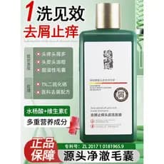 Cabelo Zhenqi shampoo anticaspa anti-coceira controle de óleo suave fragrância shampoo oficial genuíno couro cabeludo Sh