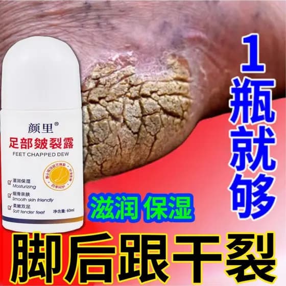 Creme reparador de rachaduras no calcanhar, Peeling morto, reparação dedicada, pele dura, rachaduras no calcanhar, hidra