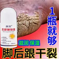 Creme reparador de rachaduras no calcanhar, Peeling morto, reparação dedicada, pele dura, rachaduras no calcanhar, hidra